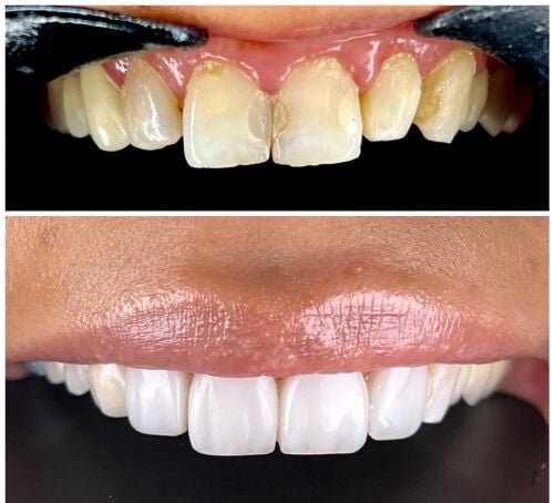 dental technician and assistant