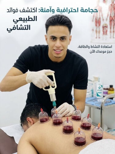 حجامه احترافيه وعلاجيه