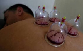 الحجامه شفاء ووقاية من الأمراض 