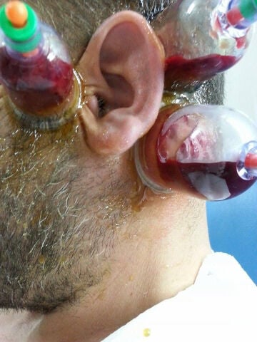 حجامه الراس بدون حلاقه الشعر 