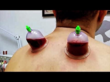 اخصائي حجامه خبره 