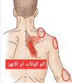 حجامه الابهر والخلعه 