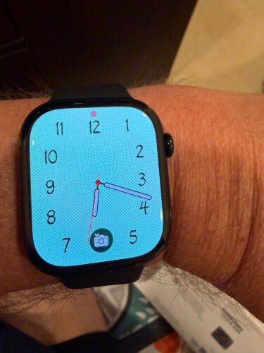 Apple Watch Series 11 – 46 mm GPS