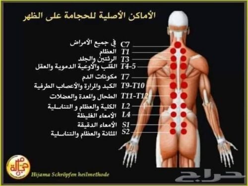حجامه نبويه