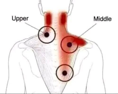 حجامه لعلاج الم الابهر