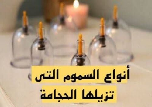 حجامه علاجيه