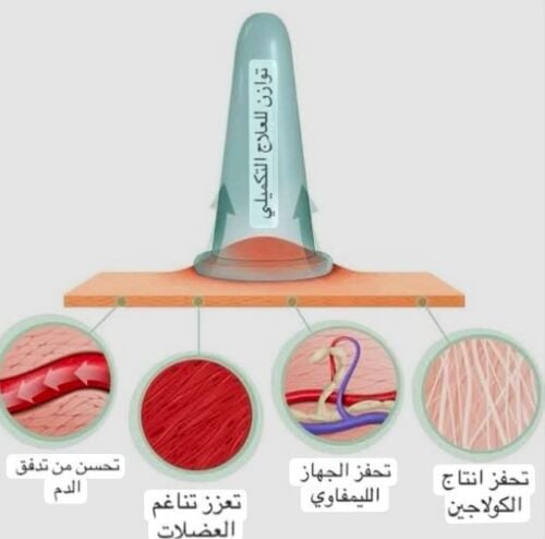 حجامه طبيه علاجيه ووقائه