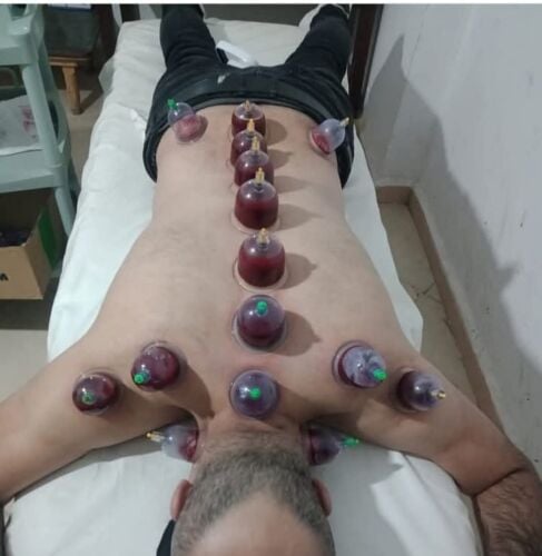 اخصائي علاج طبيعي