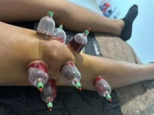 اخصائي الطب التكميلي