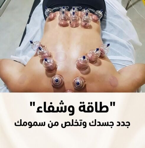 اخصائيين حجامه للرجال والنساء