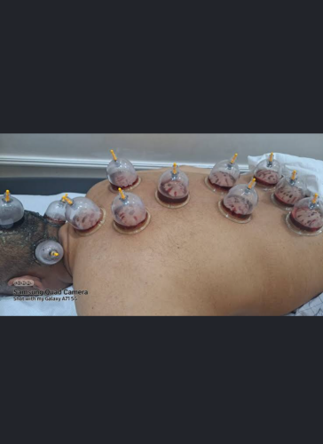 حجامه الرأس والظهر والاكتاف